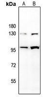 CD85j antibody