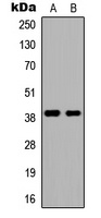 Anti-DMRTC2 Antibody