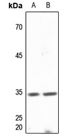 DNAJB2 antibody