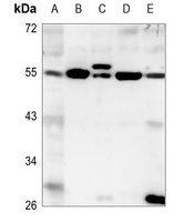 Anti-EYA1 Antibody