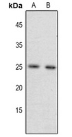 FGF17 antibody