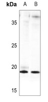 Anti-FGF4 Antibody