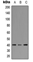 Anti-FPR3 Antibody