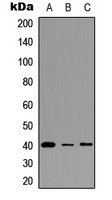 Anti-FPR3 Antibody