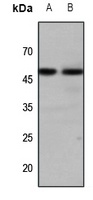 GALR1 antibody