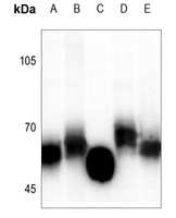 Anti-GGT5 HC Antibody