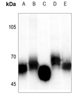 GGT5 HC antibody