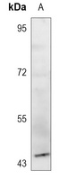 Anti-GPR143 Antibody
