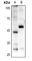 GPR85 antibody