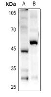 Anti-GPR85 Antibody