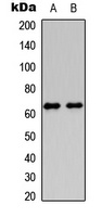 Anti-HABP2 HC Antibody