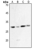 Anti-HLA-DQB1 Antibody