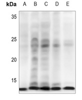 Anti-IGF1 Antibody