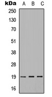 Anti-IMMP1L Antibody