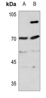 ITIH4 70k antibody