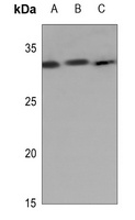 Kallikrein 7 antibody