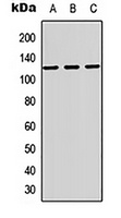 Anti-MAG Antibody