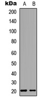Anti-MED28 Antibody