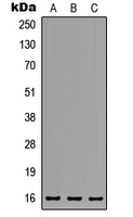 MED31 antibody