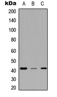 Anti-MESP2 Antibody