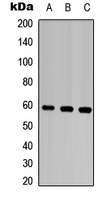Anti-MMP28 Antibody