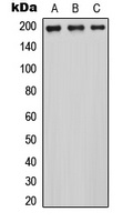 Anti-MRCK alpha Antibody