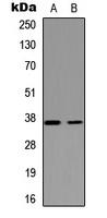 NEIL2 antibody