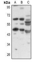 Anti-OCTN1 Antibody
