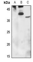 Anti-Orosomucoid 1 Antibody