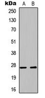 Anti-PLUNC Antibody