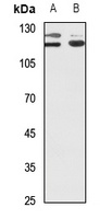 PPP1R13B antibody