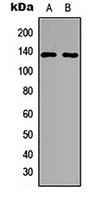 Anti-PPP4R1 Antibody