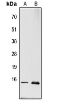 Anti-RPL22 Antibody