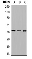 RTDR1 antibody