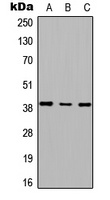 Anti-RTDR1 Antibody