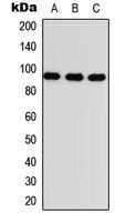Anti-TGFBR3 Antibody