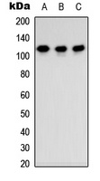 TSHZ3 antibody