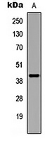 Anti-UBE2U Antibody