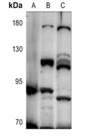 Anti-UNC5A Antibody
