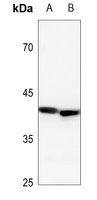 YKL-40 antibody