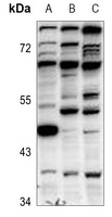 Anti-GFI1B Antibody