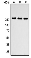 Anti-ABCA4 Antibody