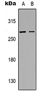 Aggrecan antibody