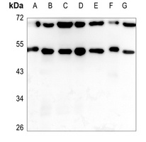 ADAMDEC1 antibody