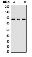 Anti-AKAP3 Antibody