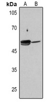 ALDH1A1 antibody