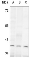 ALDOC antibody