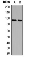 Anti-AMPD2 Antibody