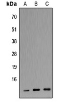 Apolipoprotein C3 antibody