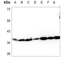 Apolipoprotein L3 antibody